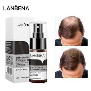 اسپری تقویت کننده و ضد ریزش مو LANBENA